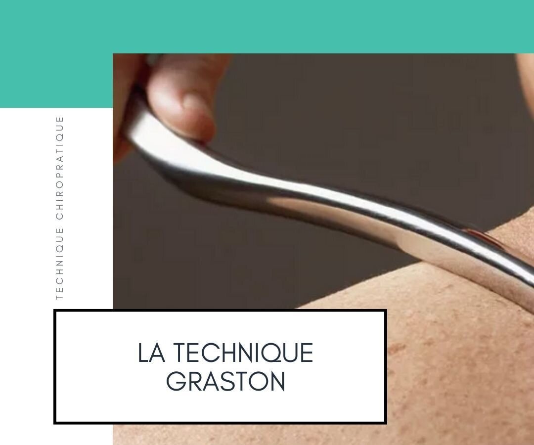 Outil en acier inoxydable Graston en application sur la peau d'un patient